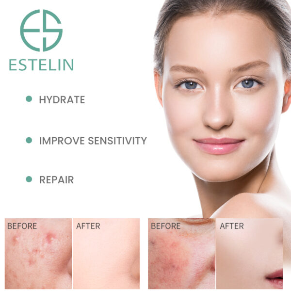 Estelin B5 Ceramide Face Serum (30ml) - Image 5